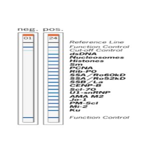 AESKUBLOTS ANA-17