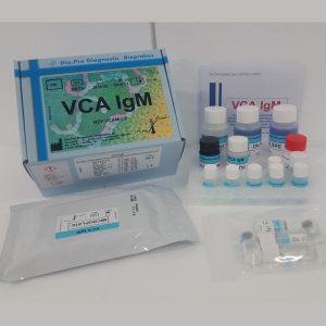 EBV VCA IgM-ELISA