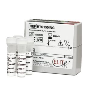 EBV ELITe MGB® Kit