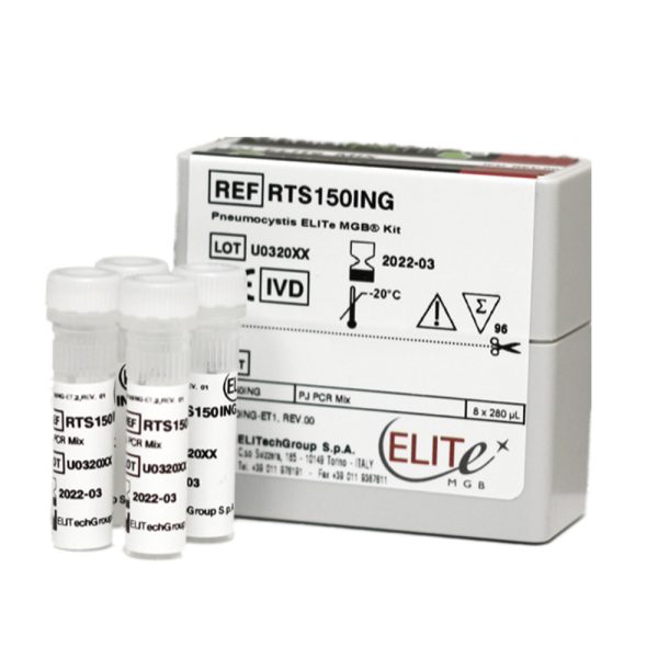 EBV ELITe MGB® Kit