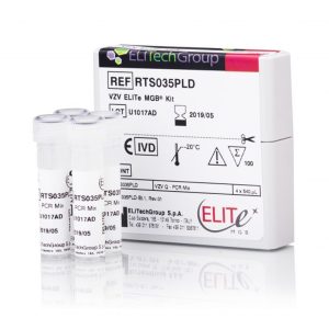 VZV ELITe MGB® Kit
