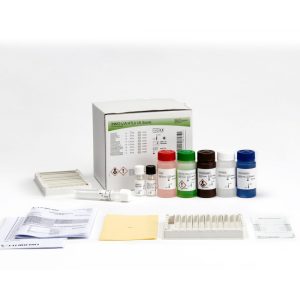 INNO-LIA® HTLV I/II Score